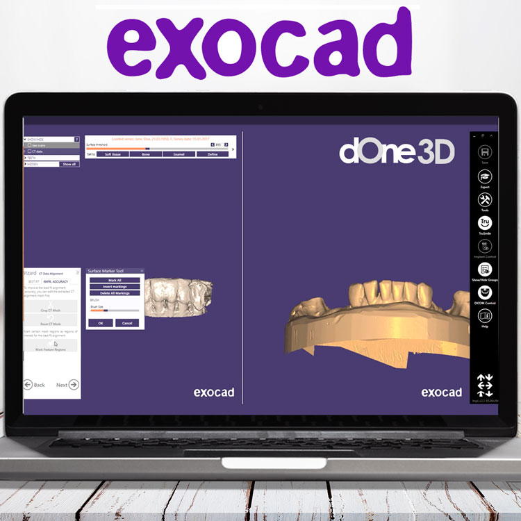 Компьютер для программы exocad